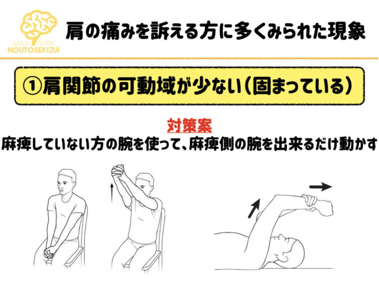 脳卒中後に肩が痛くなる人ってどれくらいいるの 脳と脊髄リハビリ研究センター