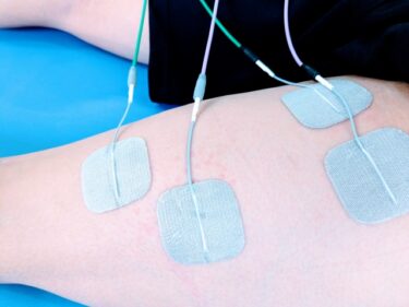 【理学療法士解説】ふくらはぎへのNMES｜効果的な電極の貼り方と位置を解説